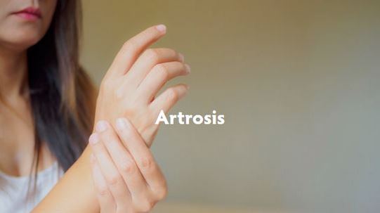 artrosis